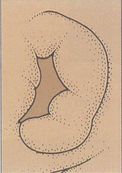 图1.1 耳廓胚胎学